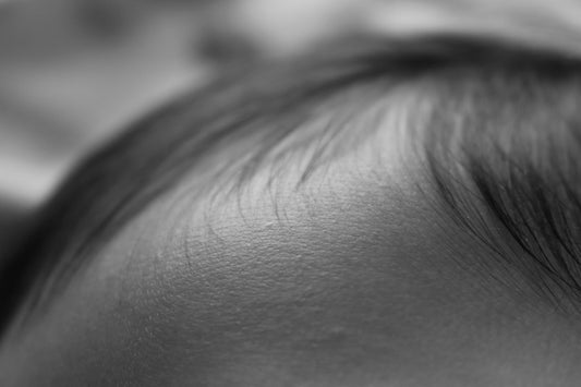 Cuir chevelu de bébé en gros plan — illustration article croûtes de lait